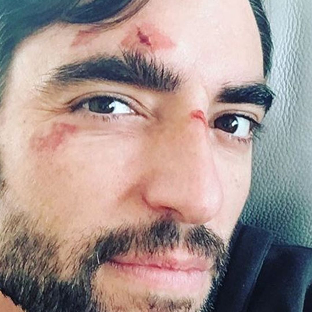 El accidentado fin de semana de Dani Mateo