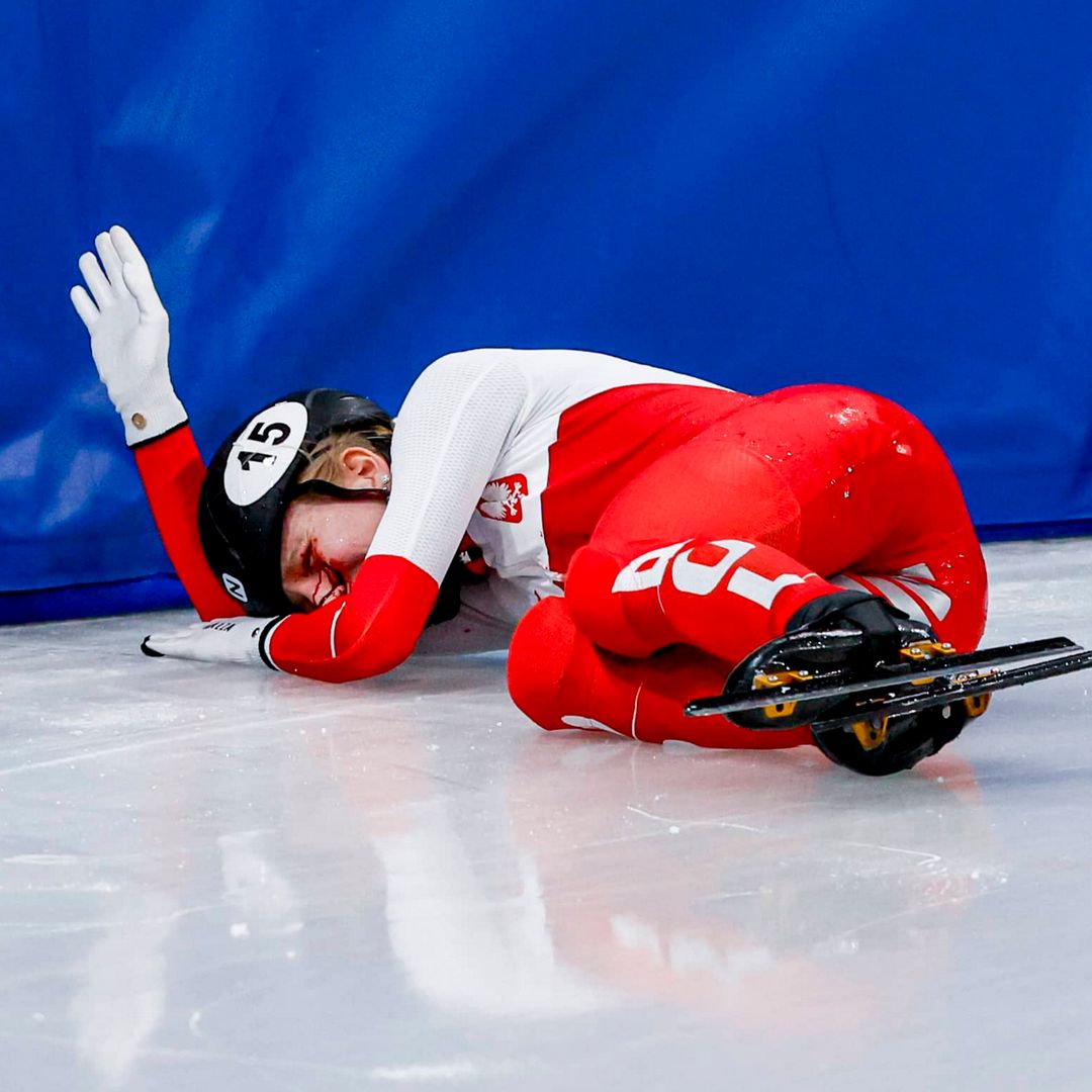 Brutal accidente en Milán-Cortina 2026: una cuchilla corta el rostro de la patinadora Kamila Sellier en plena carrera