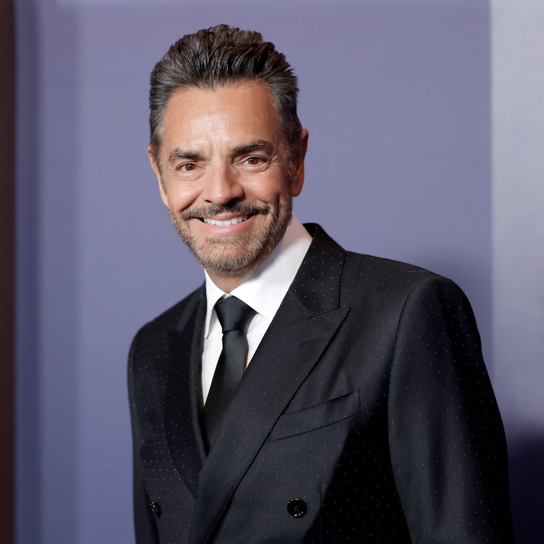 Eugenio Derbez aparece en redes con el rostro hinchado y algunas ronchas, ¿qué le pasó?