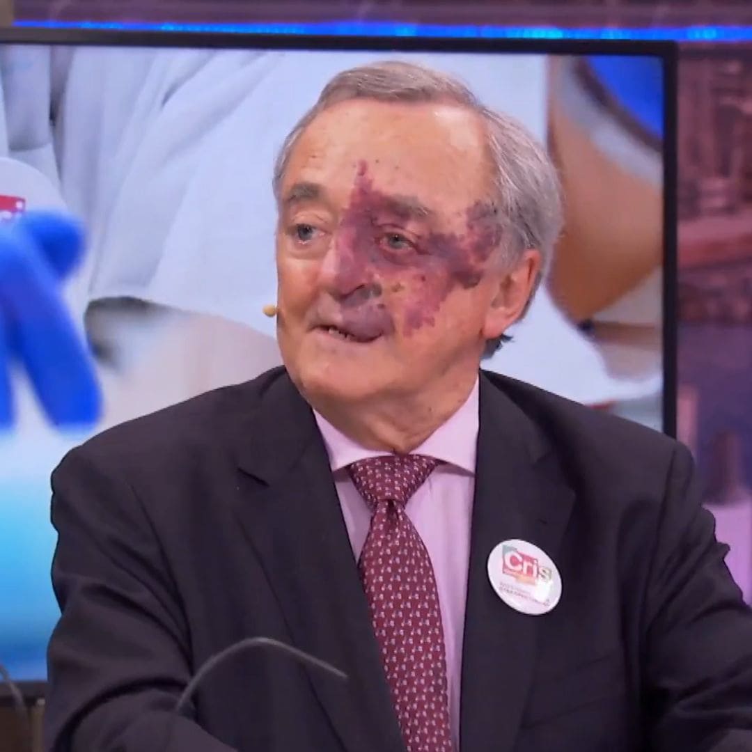 El gran avance de Mariano Barbacid contra el cáncer de páncreas: por qué aún no puede usarse en humanos