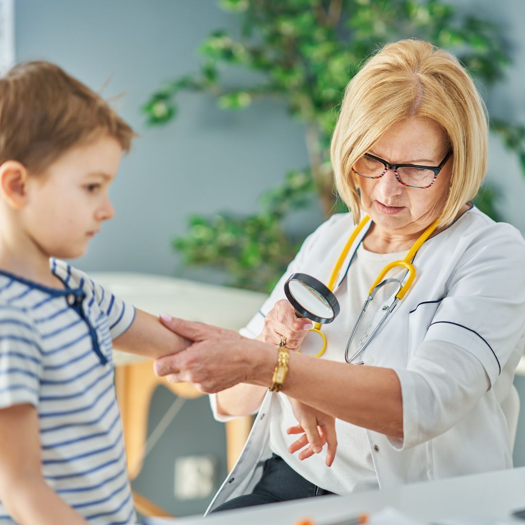 ¿Por qué algunos niños tienen verrugas? ¿Cuándo debemos preocuparnos?