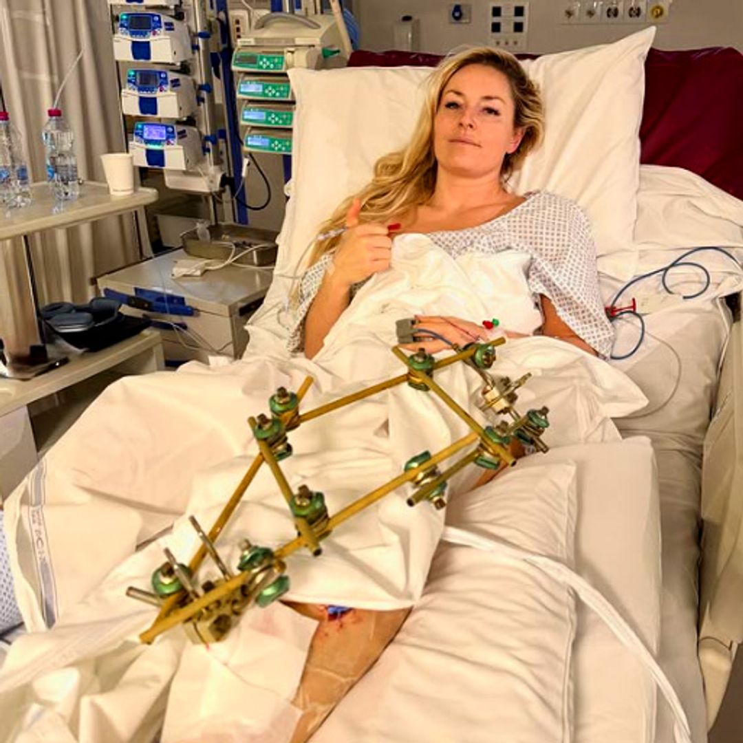 Lindsey Vonn habla desde el hospital tras su drama con las operaciones: "Están siendo unos días bastantes duros"