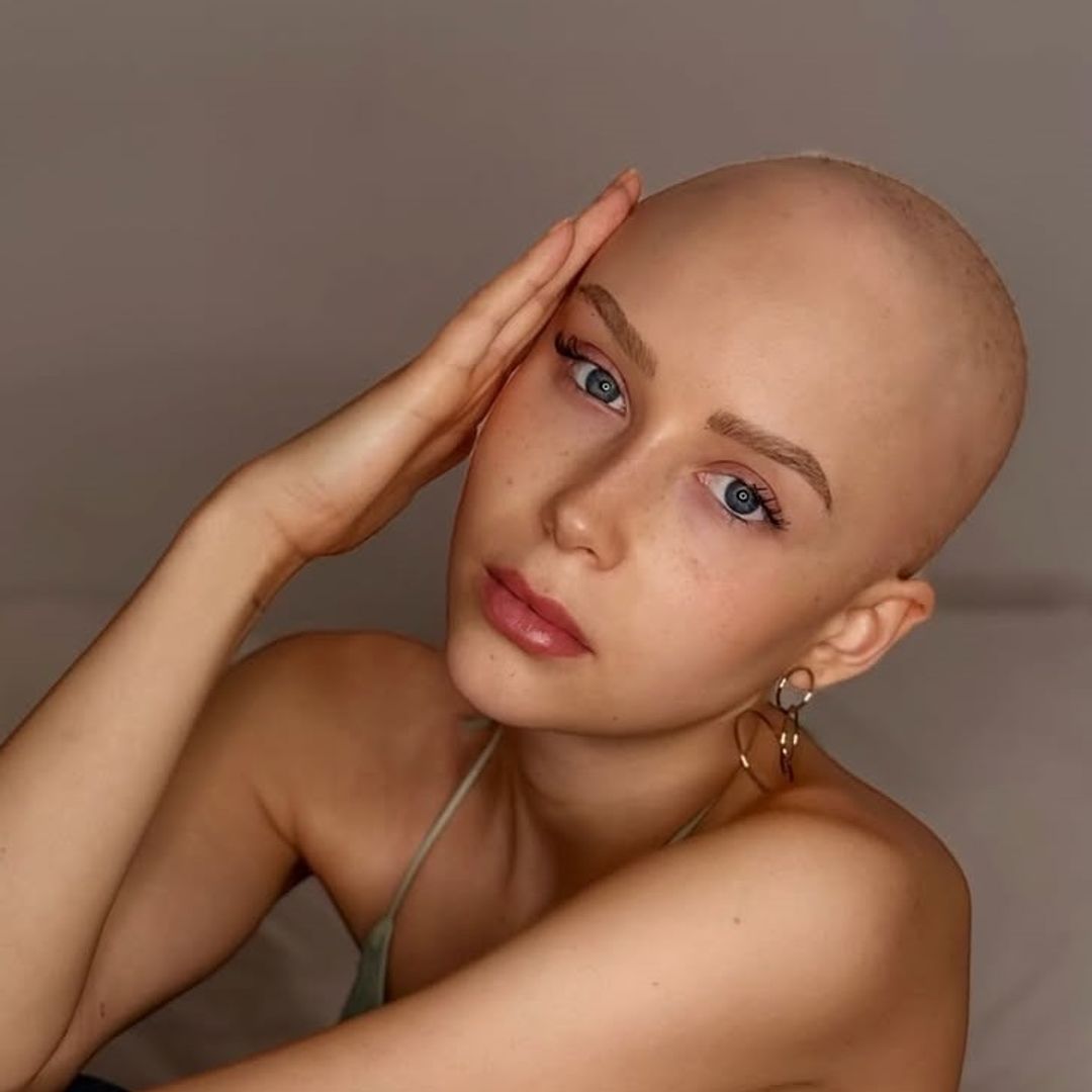La 'influencer' Natalia Jiménez habla de las secuelas que le dejó la quimioterapia: "Mi cabeza va más lenta"