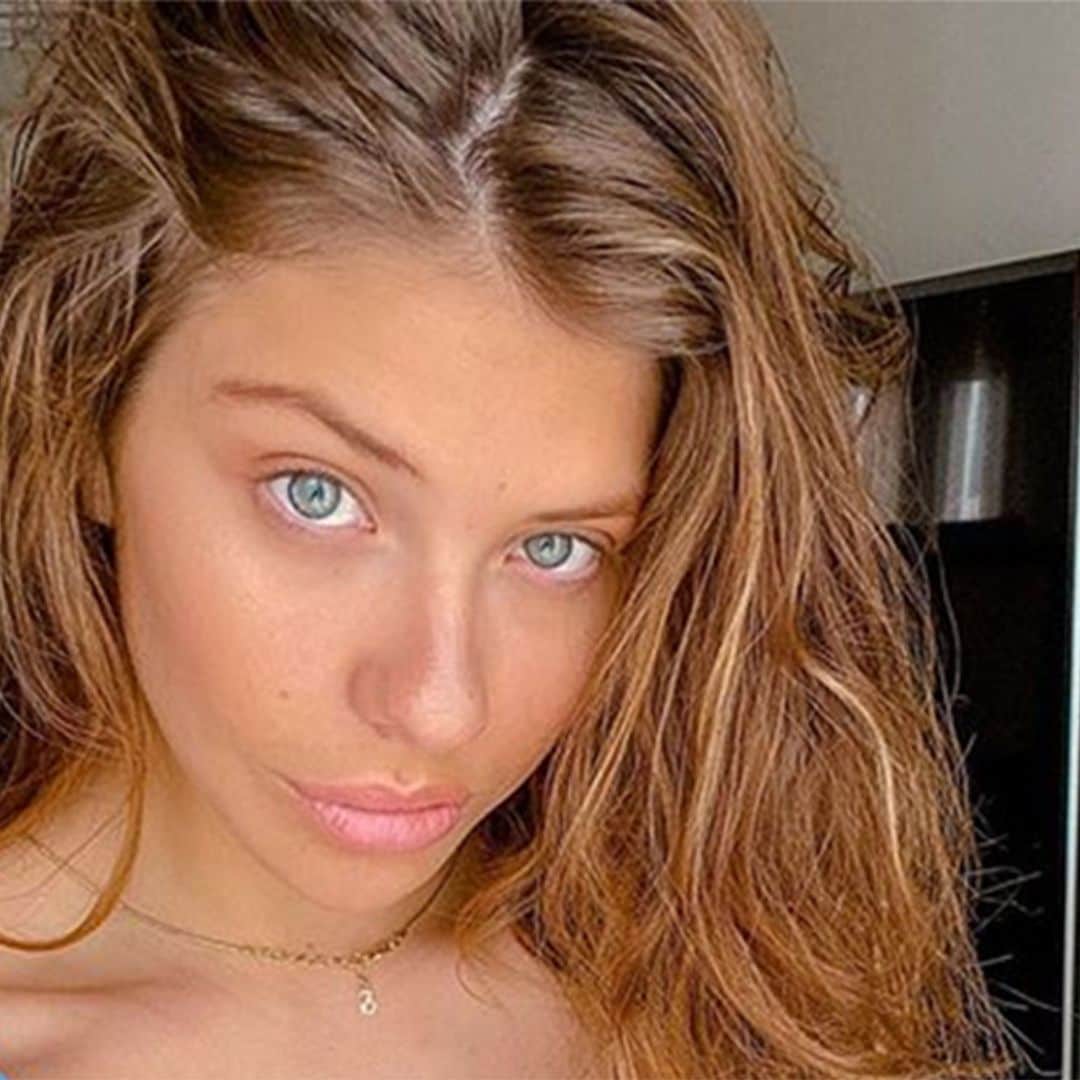 Ana Matamoros, operada en pleno confinamiento tras sufrir un accidente doméstico