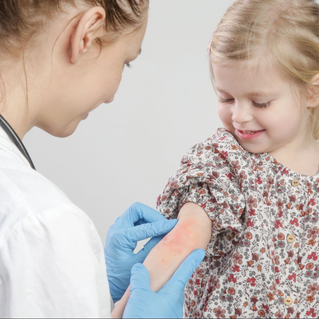 Exantema súbito en niños: guía completa para padres sobre esta erupción común