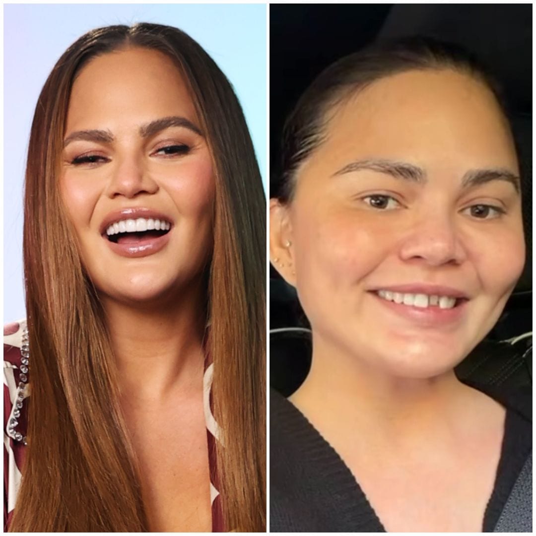 Chrissy Teigen vive un divertido accidente navideño y pierde un diente postizo