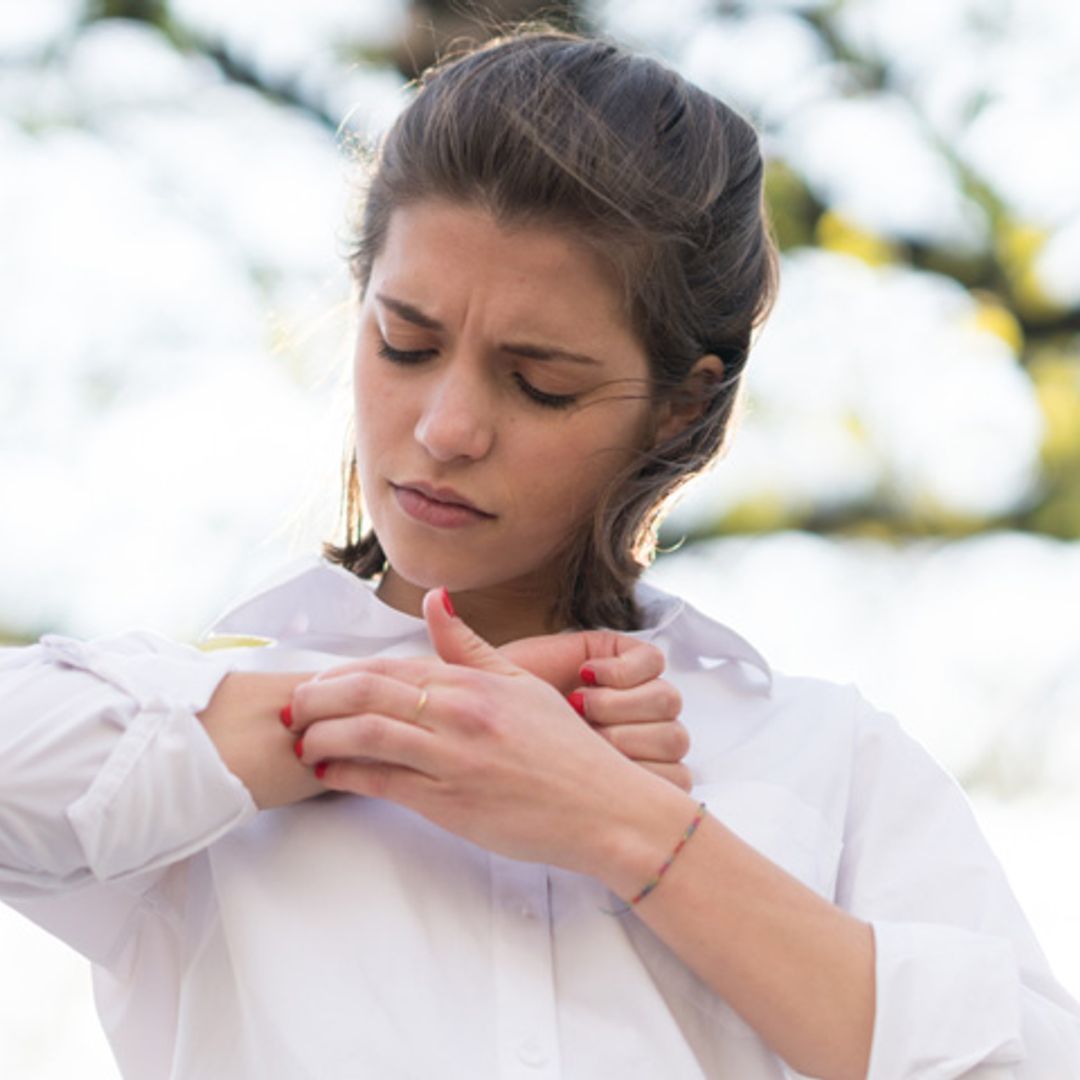 Dermatitis atópica, mucho más que un simple picor de la piel