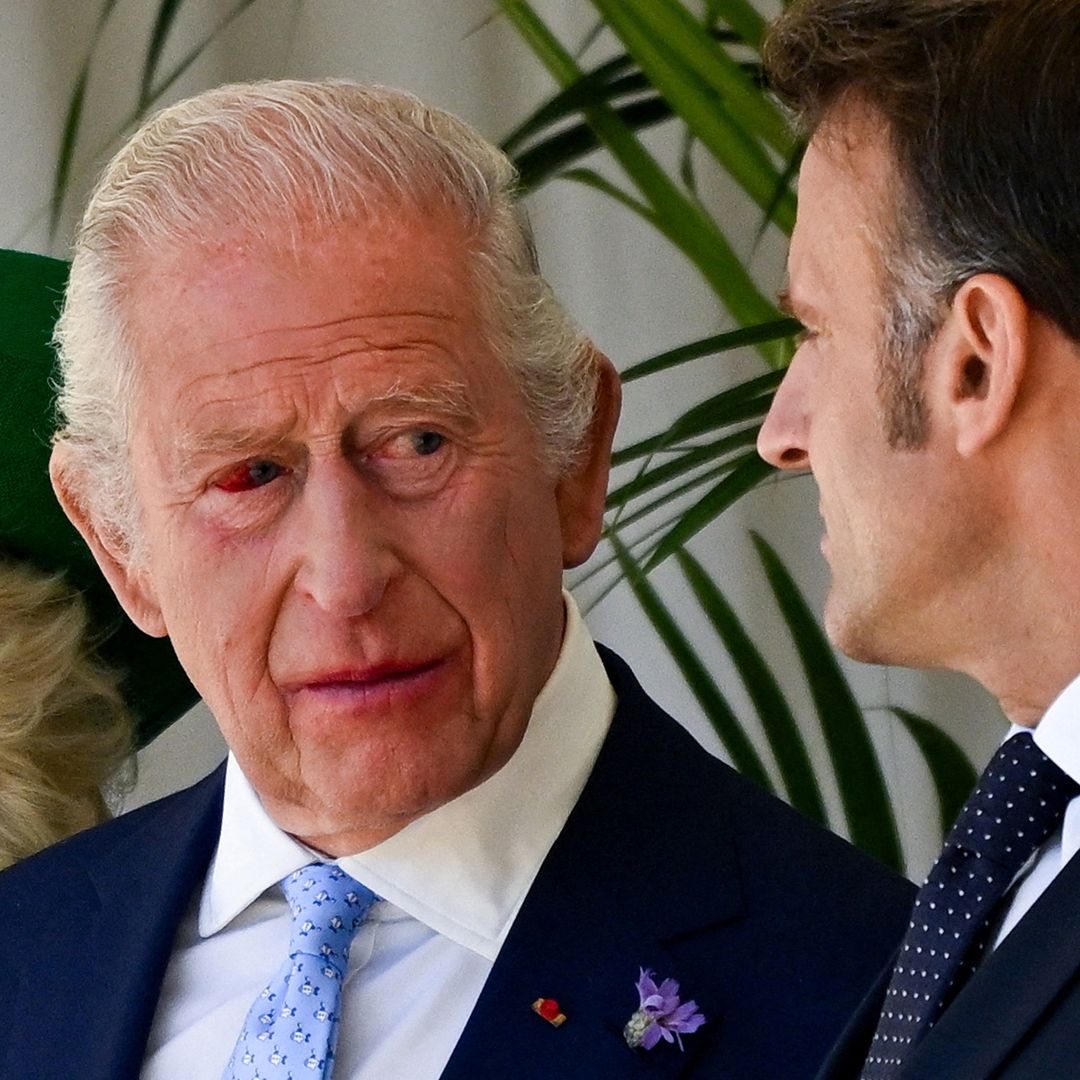El rey Carlos III, afectado por un problema de salud de última hora antes de la recepción