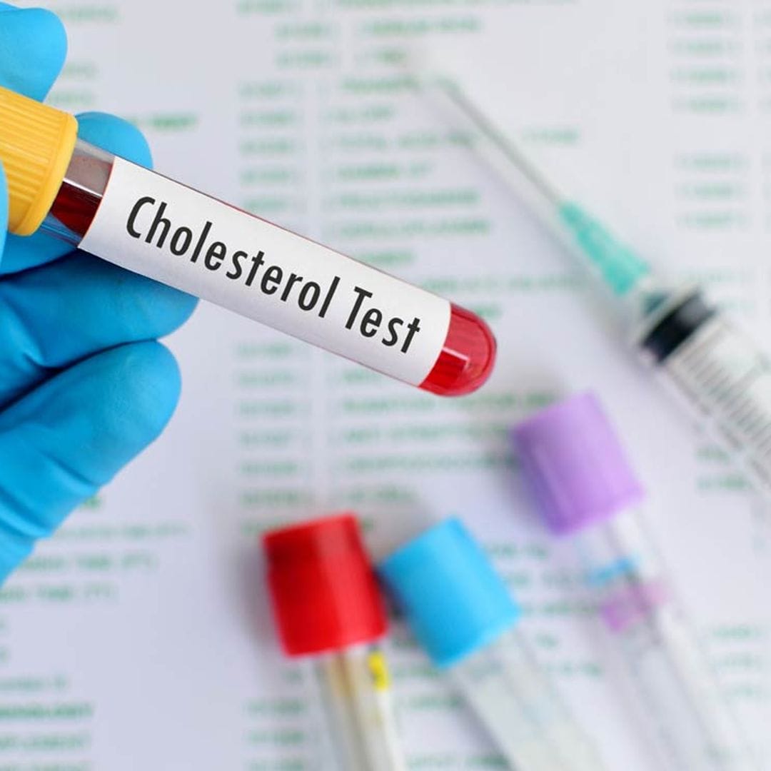 ¿Hay uno bueno y uno malo? Cómo interpretar las cifras de colesterol en un análisis de sangre