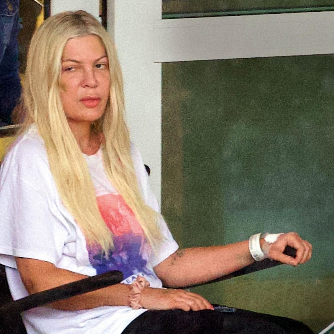 EN IMÁGENES: Tori Spelling sale magullada del hospital y pasa de vivir en una mansión de 120 millones a una autocaravana