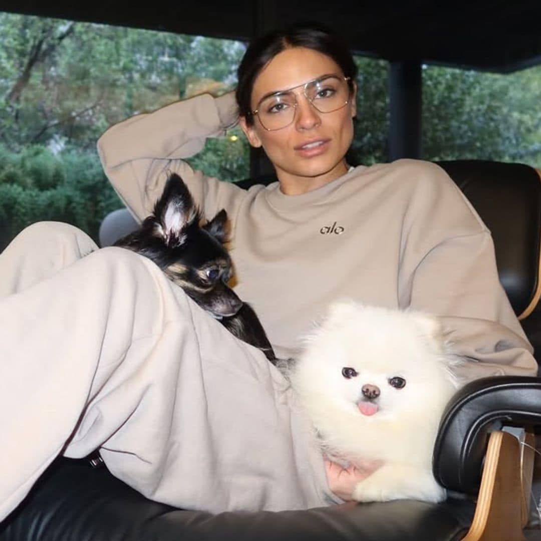 Ana Brenda Contreras habla sobre su lucha contra la endometriosis: 'Solo las personas que lo vivimos sabemos el dolor'