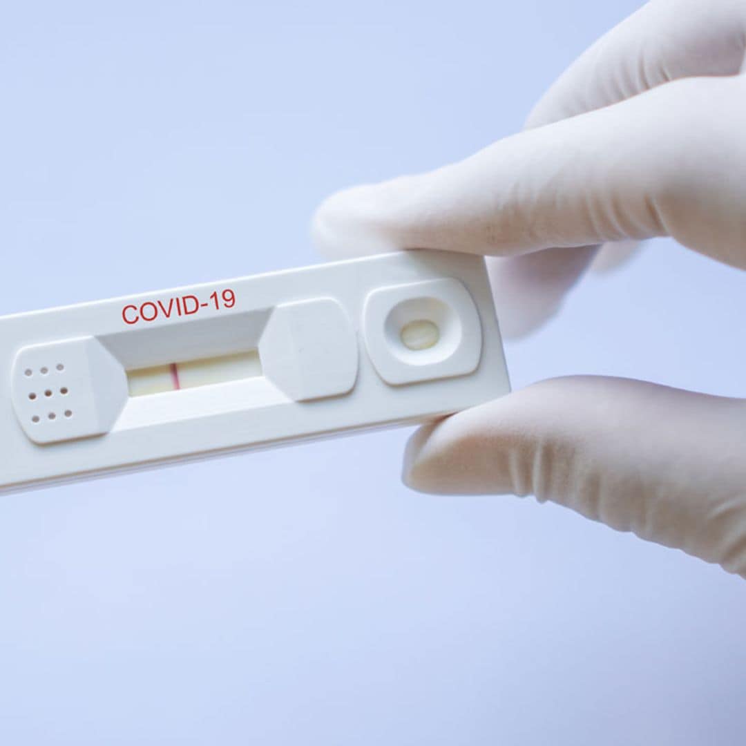 ¿Cómo puedo saber si he pasado la Covid-19?