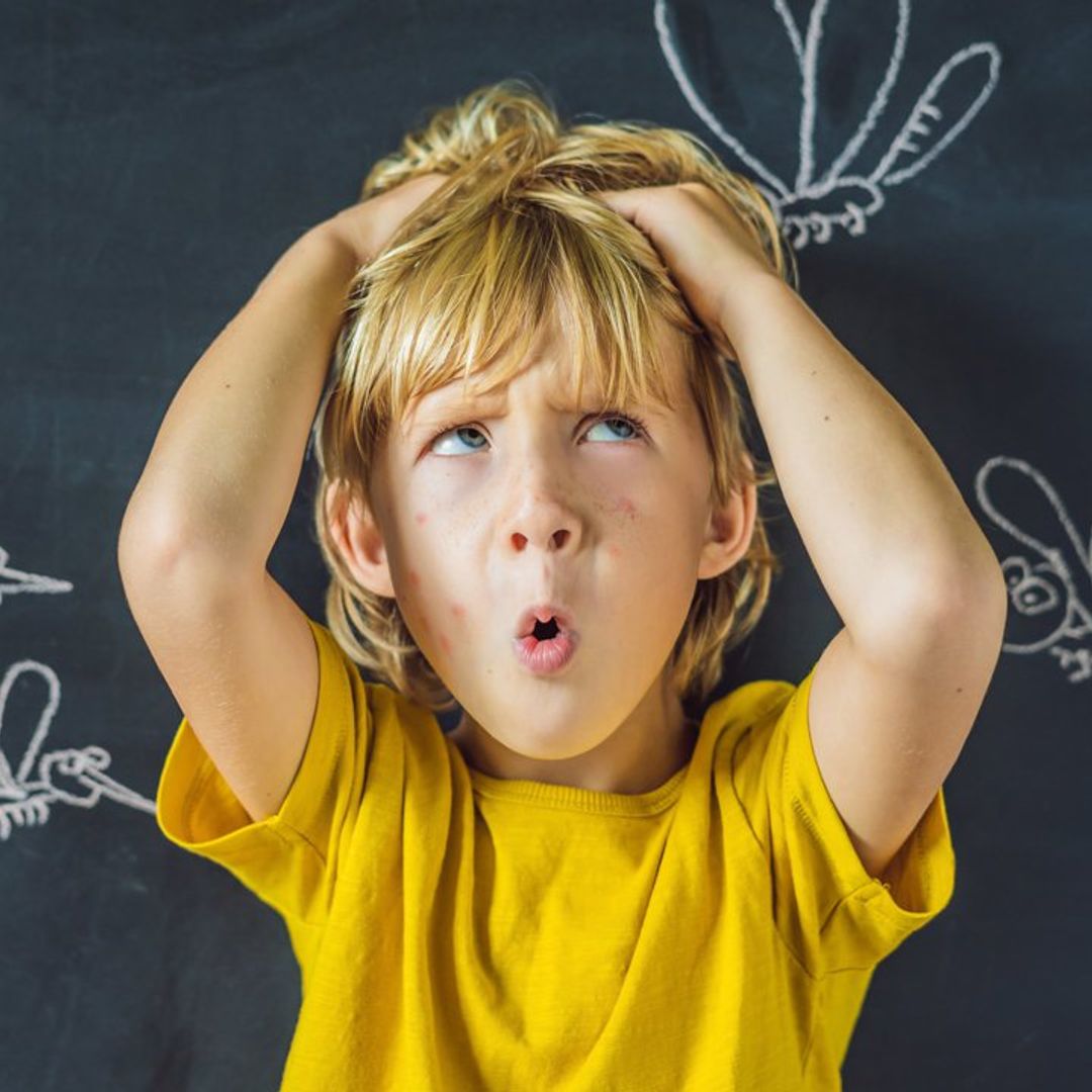 Con estos consejos, protegerás a tus hijos de las picaduras