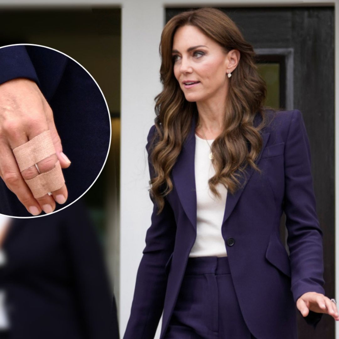 El motivo por el que la princesa de Gales ha llevado vendada su mano en su última aparición pública
