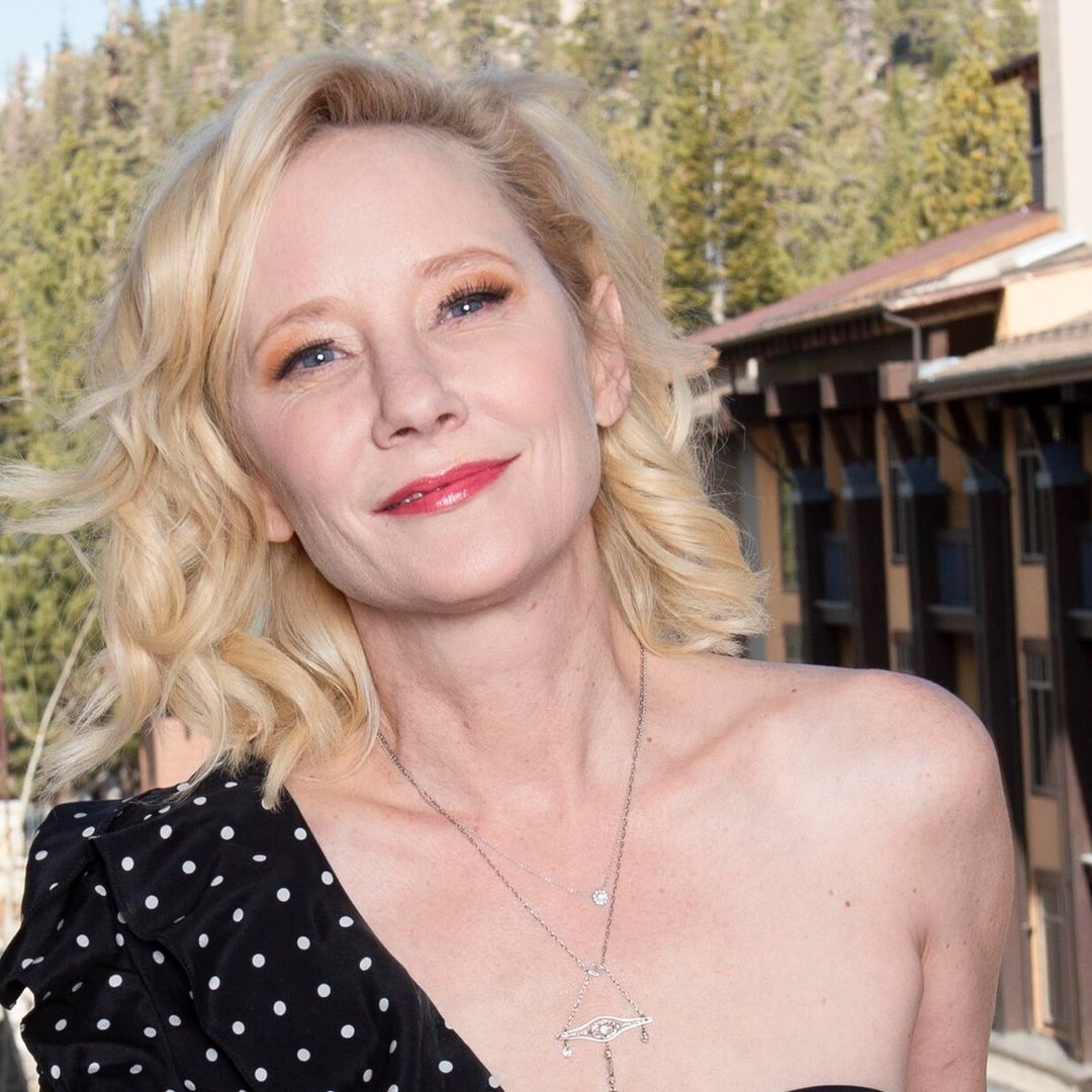 Muere la actriz Anne Heche por lesión cerebral, tras incidente automovilístico