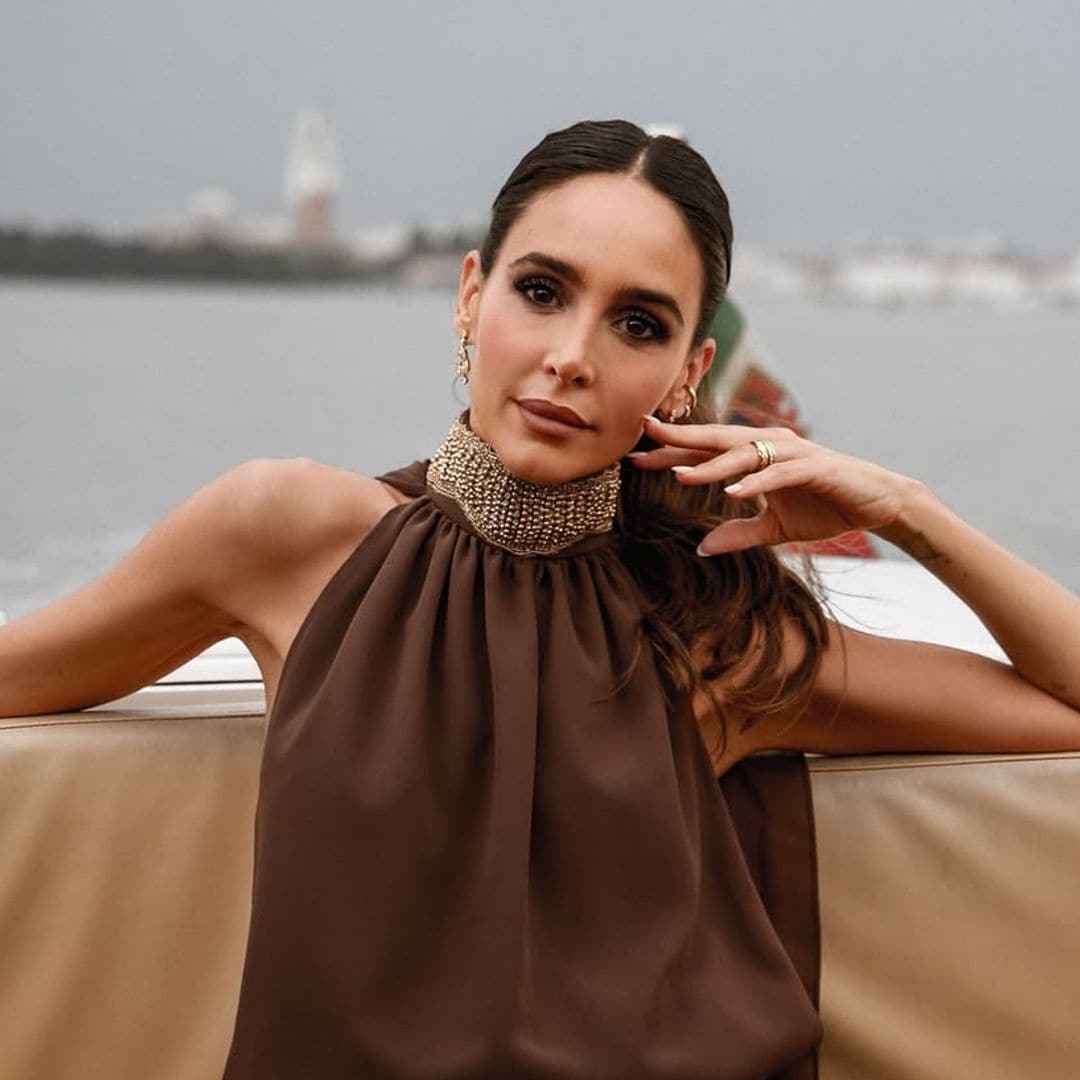 Rocío Osorno también sufre caída del pelo por estrés: cómo evitarla según un tricólogo