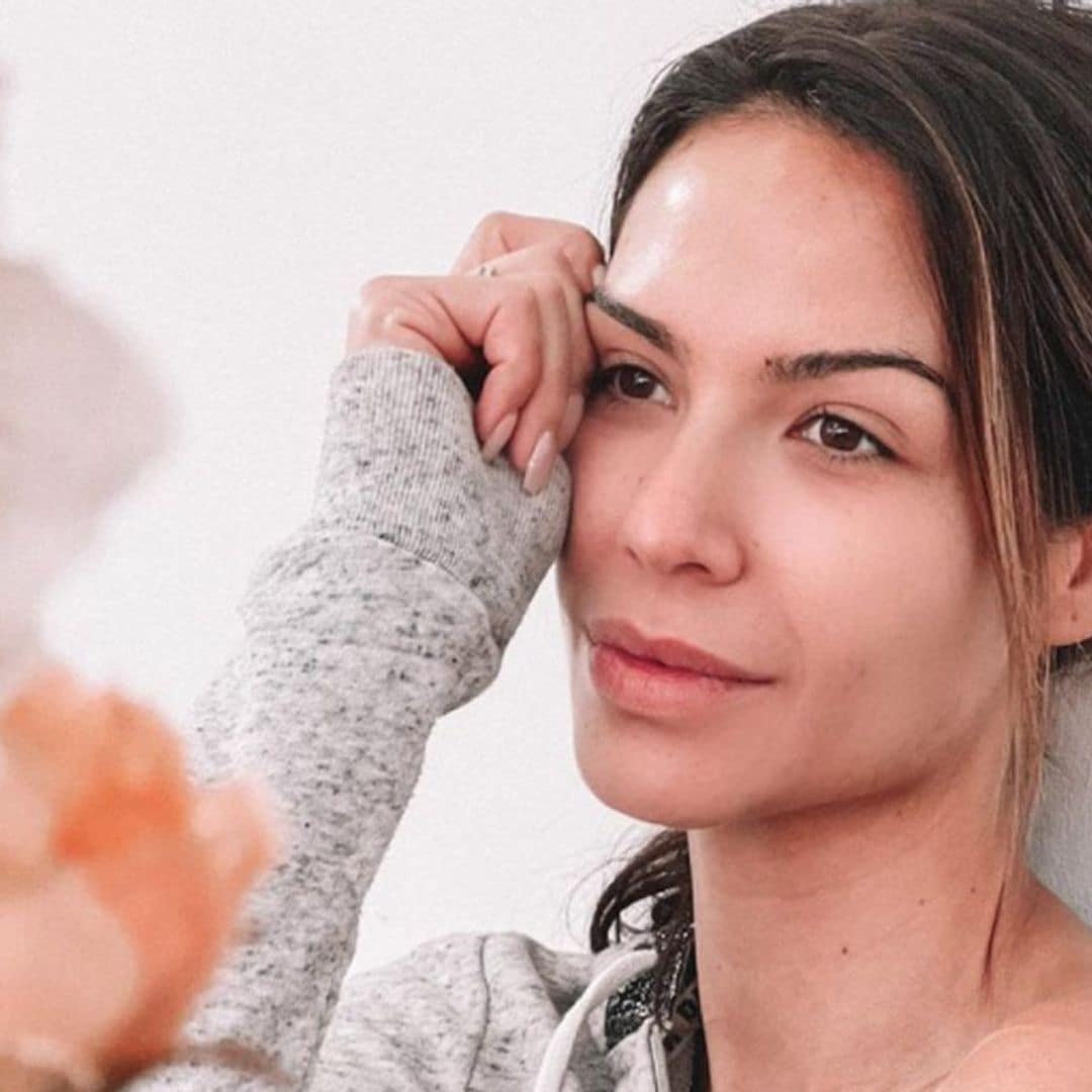 Tamara Gorro muestra una impactante consecuencia de su enfermedad