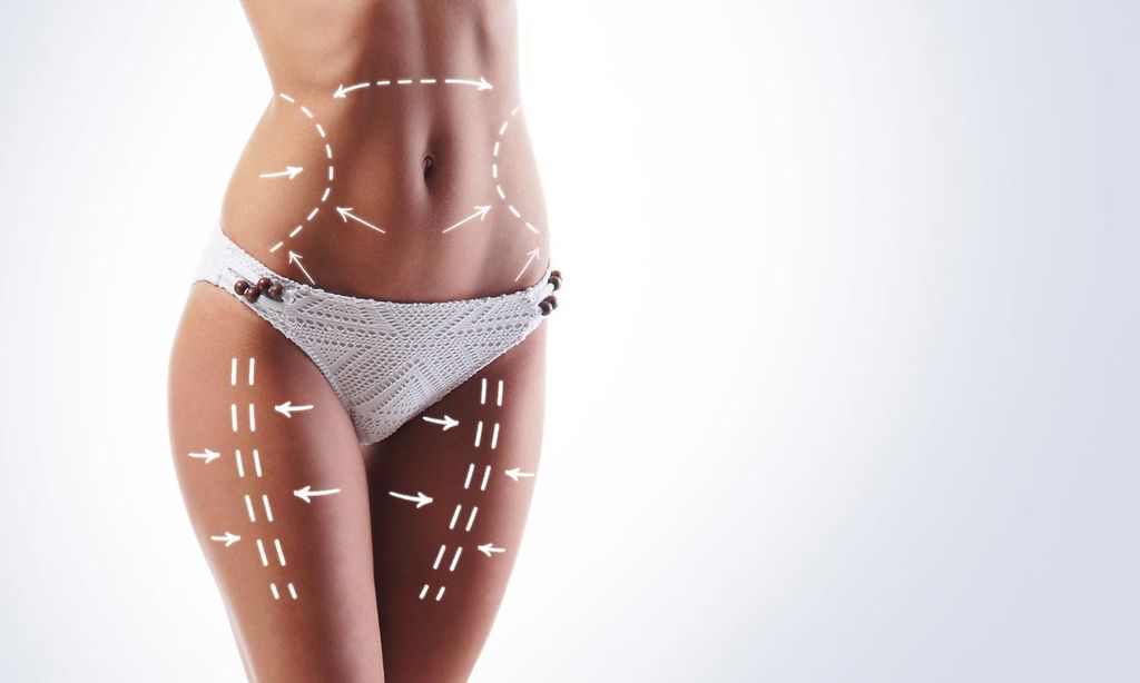 ¿Estás pensando en una liposucción? Estas son las recomendaciones de los expertos