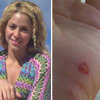 Shakira es atacada por un león marino y Gerard Piqué sufre un leve accidente de tráfico