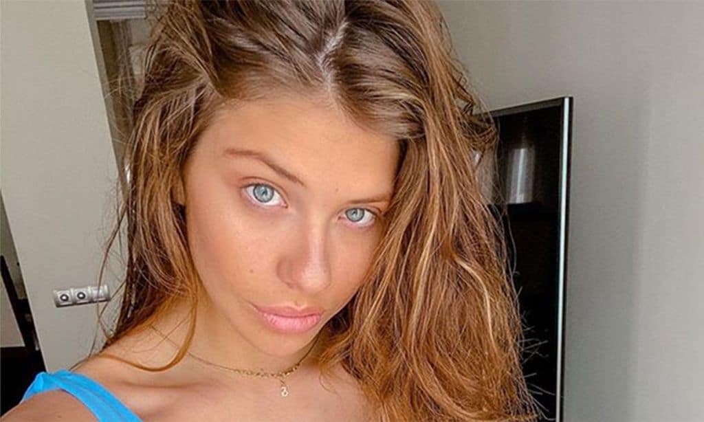 Ana Matamoros, operada en pleno confinamiento tras sufrir un accidente doméstico
