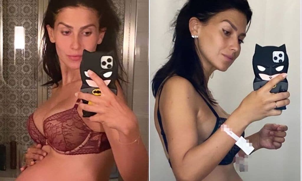 Hilaria Baldwin comparte el antes y el después de su cuerpo tras dar a luz a su quinto hijo