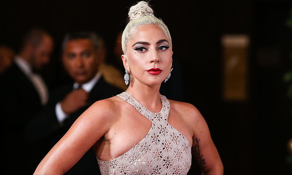 Roban dos de los perros de Lady Gaga tras disparar al hombre que los paseaba