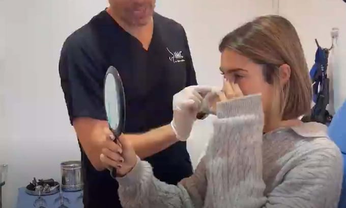 Anna Ferrer comparte con sus seguidores el momento en que ve el resultado de su operación de nariz