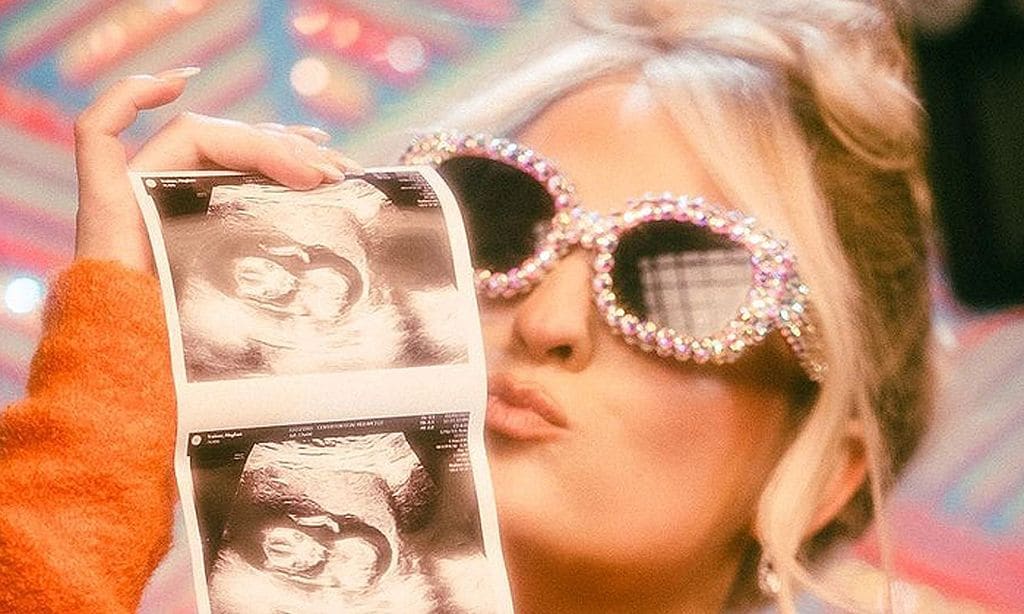 Meghan Trainor está embarazada de su segundo hijo 