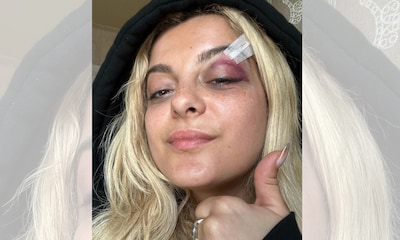 Bebe Rexha se desploma en un concierto tras ser golpeada por el móvil que le lanzó un fan