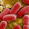 La falta de resultados sobre el origen de la E. coli desata las críticas en Alemania