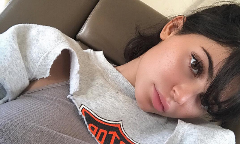 Kylie Jenner y otras celebrities con pecas: aprende a cuidarlas de forma correcta