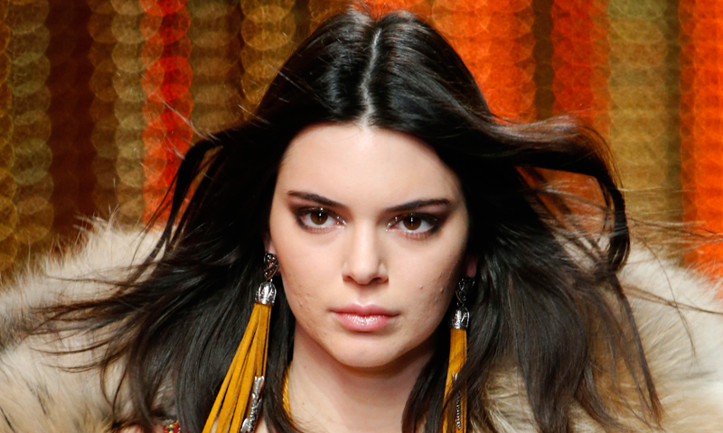 No estás sola Kendall Jenner, estas 'celebrities' también sufren problemas de acné
