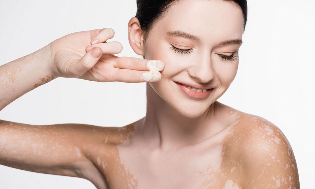 ¿Es posible eliminar las manchas blancas de la piel? Un experto responde nuestras preguntas