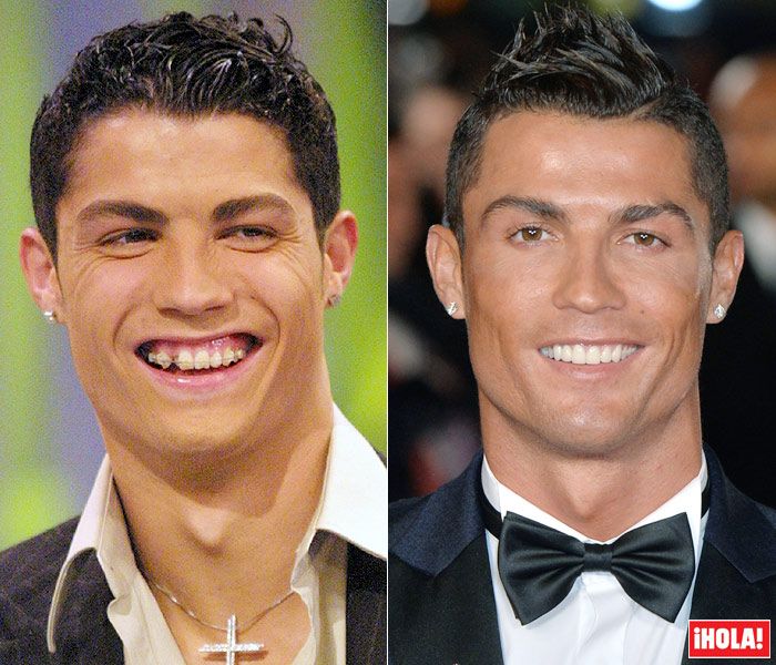 Cristiano ronaldo sigue siendo feo aunque se opere, no hay remedio...