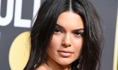 ¿Qué puedes hacer si tienes un brote de acné como el de Kendall Jenner?