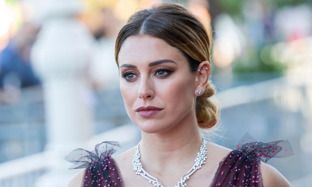 ¿Qué es el 'face framing' que se ha hecho Blanca Suárez?