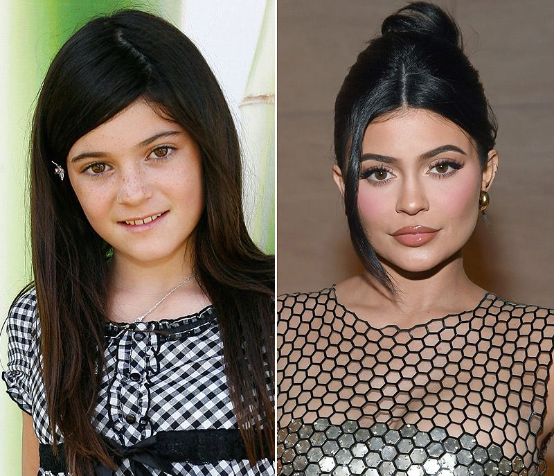 kylie-cambio1-a