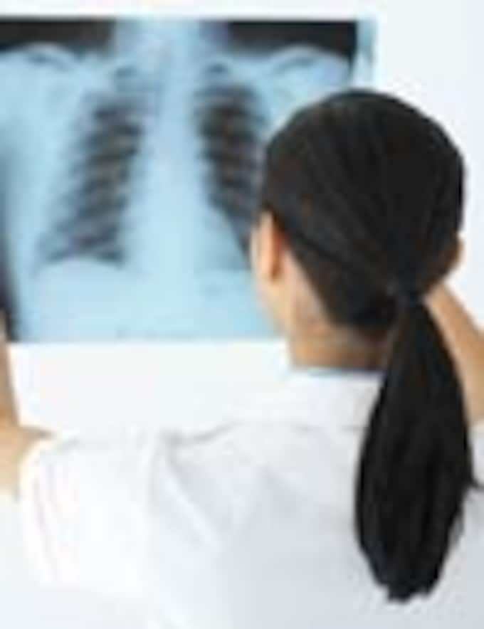 ¿Has oído hablar alguna vez de la hipertensión pulmonar?