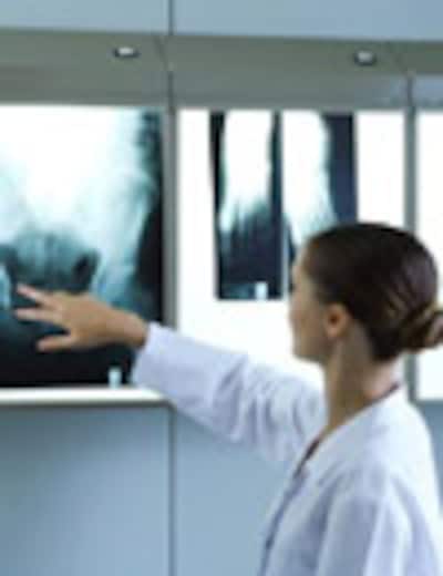 Radiografías, ecografías, mamografías... ¿qué nos revelan las imágenes médicas?