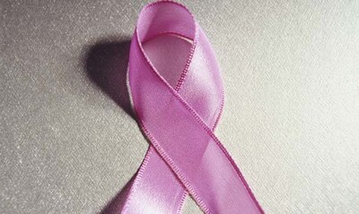 Consultorio oncológico: Preguntas y respuestas sobre el cáncer de mama
