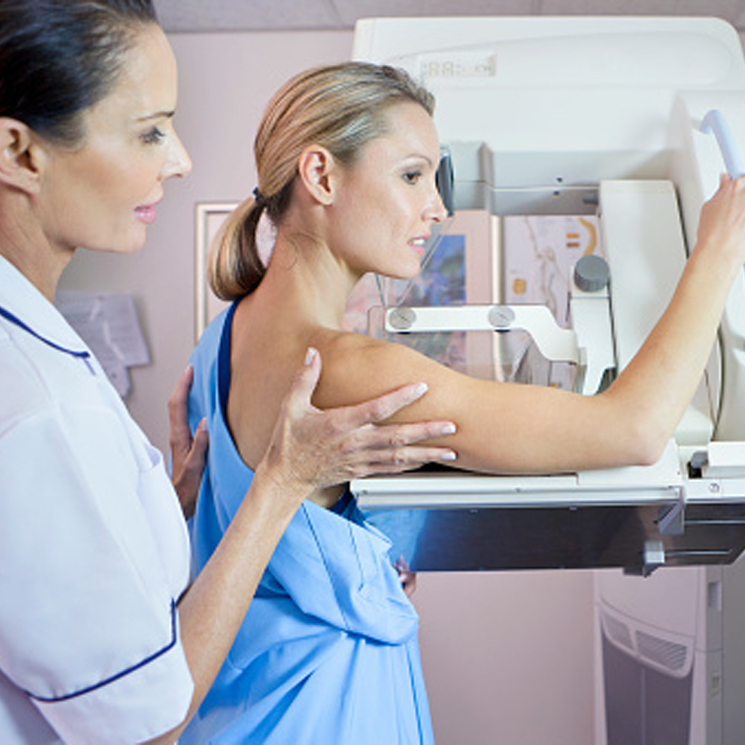 Cinco peligrosos mitos sobre las mamografías que deberías desterrar de una vez por todas