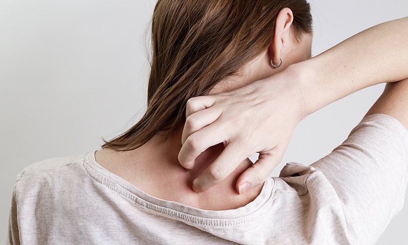Las personas que sufren psoriasis son menos felices (según un estudio)