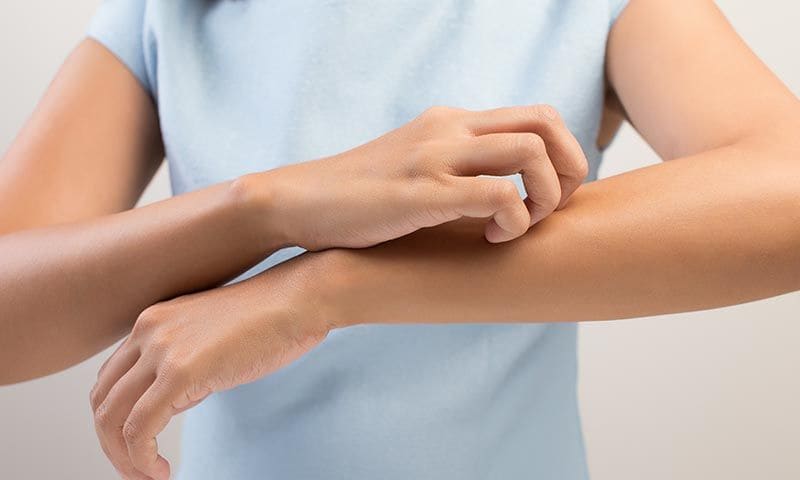 Get Pulga de mar picadura For iPhone Pulga De Mar Picadura