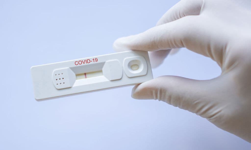 ¿Cómo puedo saber si he pasado la Covid-19?