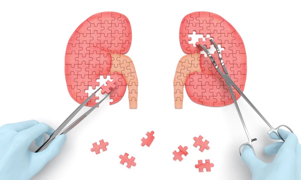 ¿Qué es un linfoma renal, el cáncer que sufre Paco, el segundo hijo de Lorenzo Sanz?