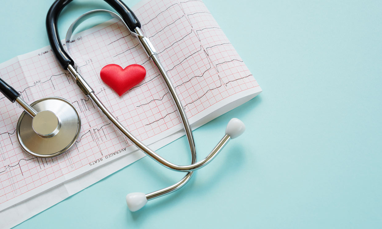 ¿Qué factores incrementan el riesgo de sufrir un ictus o un infarto agudo de miocardio?