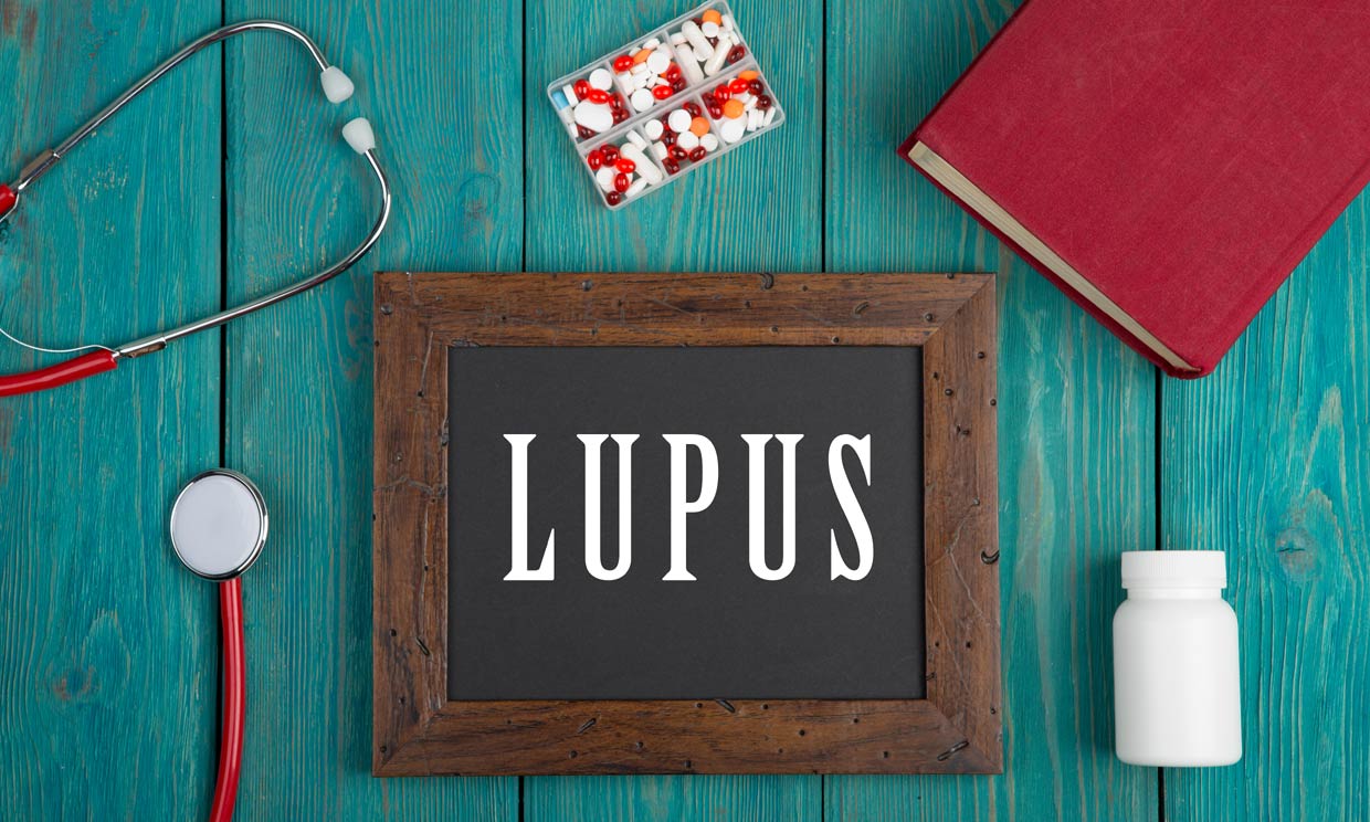 ¿Cuáles han sido los avances más significativos en el tratamiento lupus?