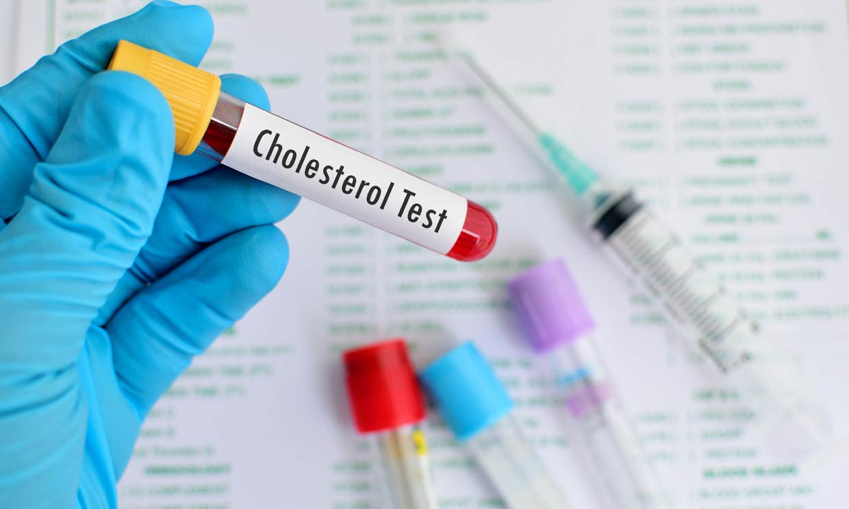 test de colesterol