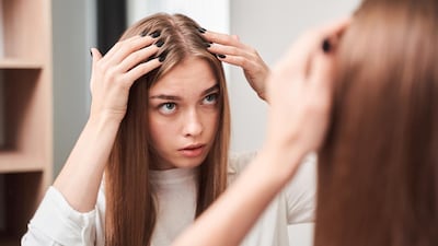 El acné también puede llegar al cuero cabelludo: ¿cómo debemos tratarlo?