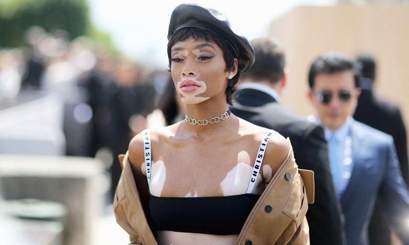 10 Modelos 'atípicas' que rompen con todos los estereotipos